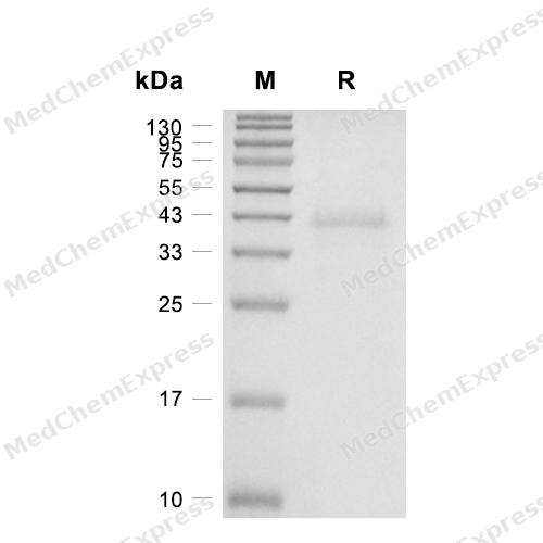NMI蛋白, Mouse (His)