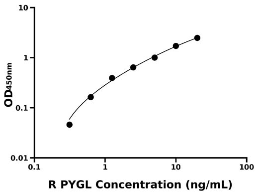 大鼠糖原磷酸化酶L(PYGL)检测试剂盒  