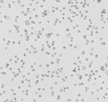 Ramos (RA 1)，人B淋巴细胞瘤细胞