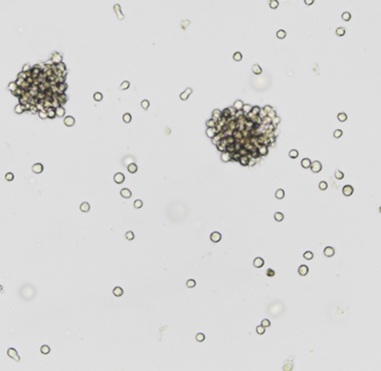 Raji，人Burkitt's淋巴瘤细胞，人B淋巴细胞瘤细胞