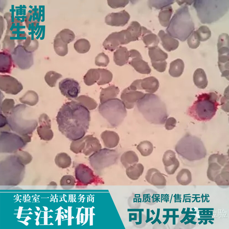 NG108-15小鼠神经瘤与大鼠神经胶质瘤之融合细胞专用培养基