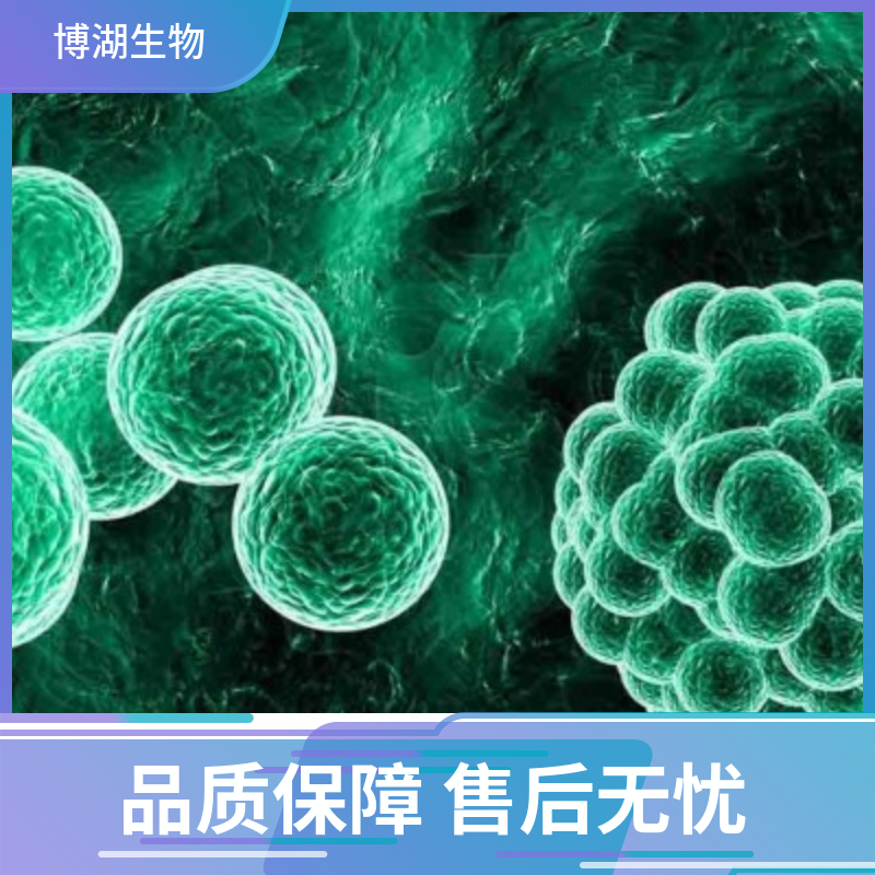 MT-4人急性淋巴母白血病细胞专用培养基