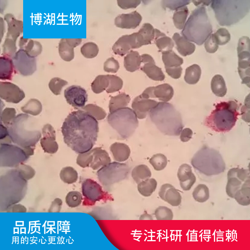 MDCK狗肾转化细胞专用培养基