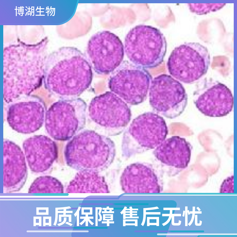 SNB-19人脑胶质瘤细胞专用培养基