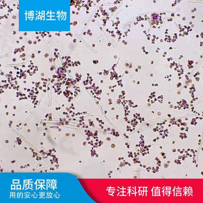 NCI-H446人小肺癌细胞专用培养基