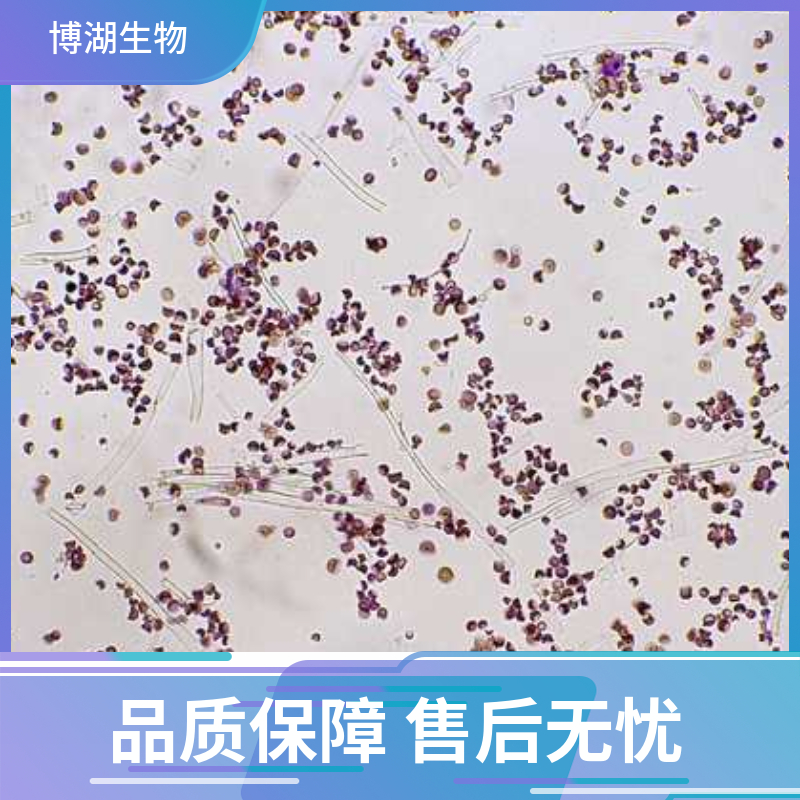 大鼠脑微血管内皮细胞永生化细胞专用培养基