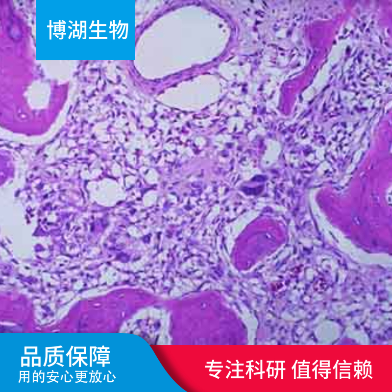 湖羊瘤胃上皮细胞永生化细胞专用培养基
