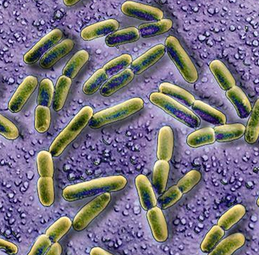 Klebsiella pneumoniae