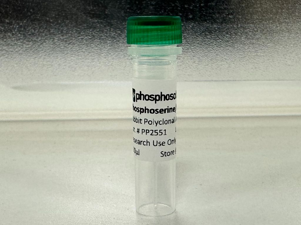 通用磷酸化抗体-抗磷酸化丝氨酸/苏氨酸