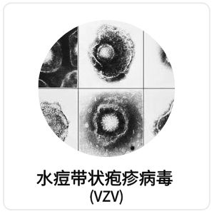 水痘带状疱疹病毒（VZV）相关抗原抗体