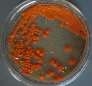 Pseudozyma Tsukubaensis