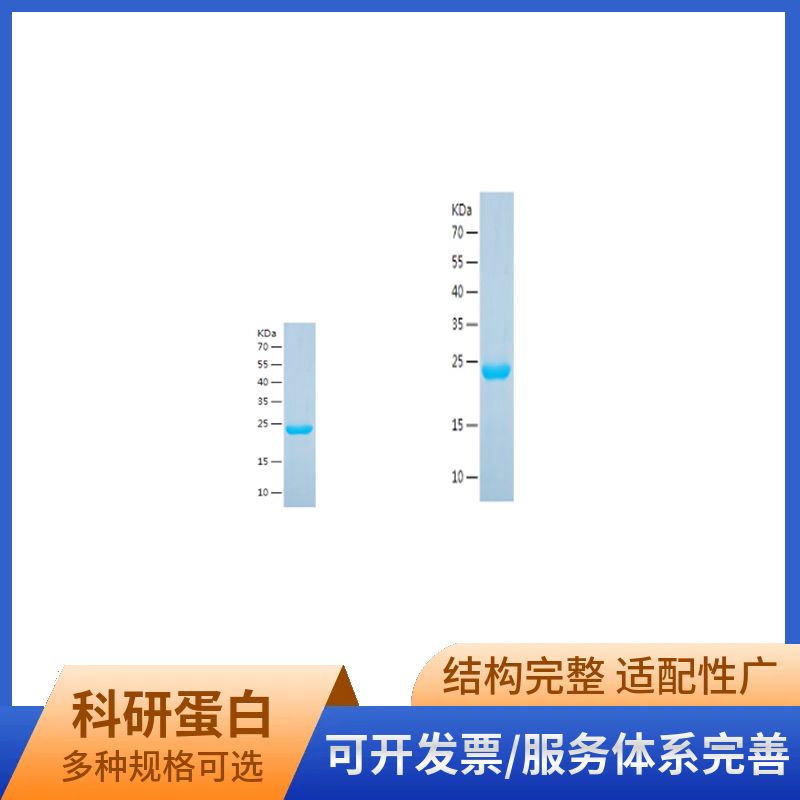 Recombinant Human BRD2