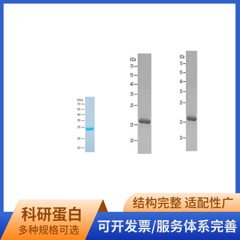 Recombinant Human BRD2