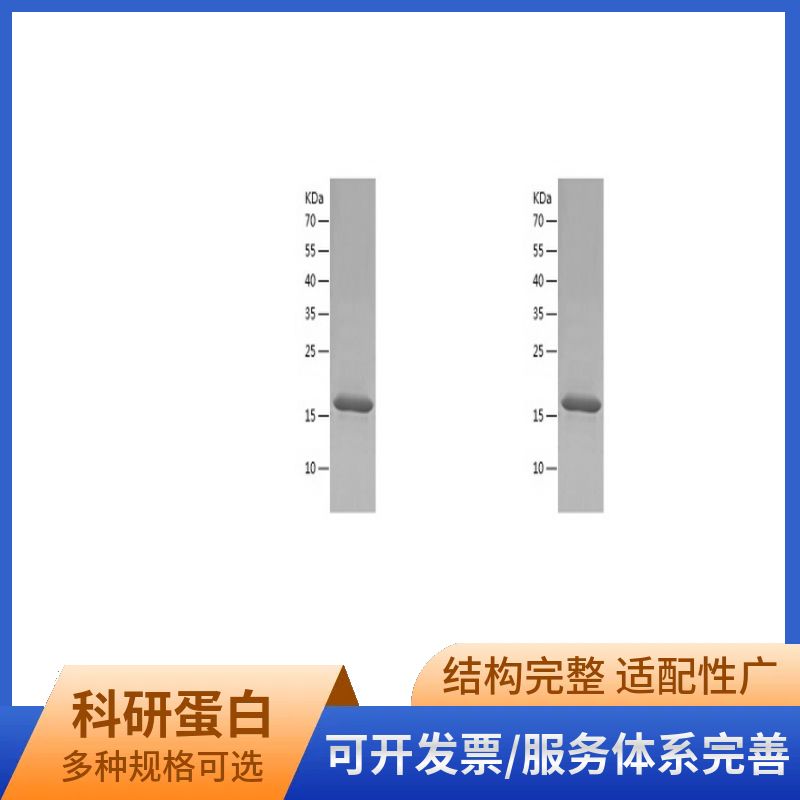 Recombinant Human ABCA5