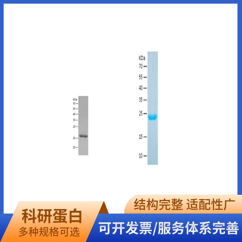 Recombinant Human ABCA5
