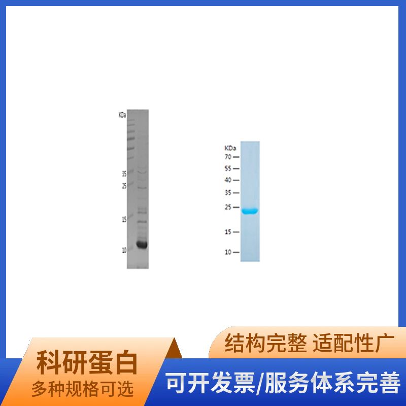 Recombinant Human Cystatin-B