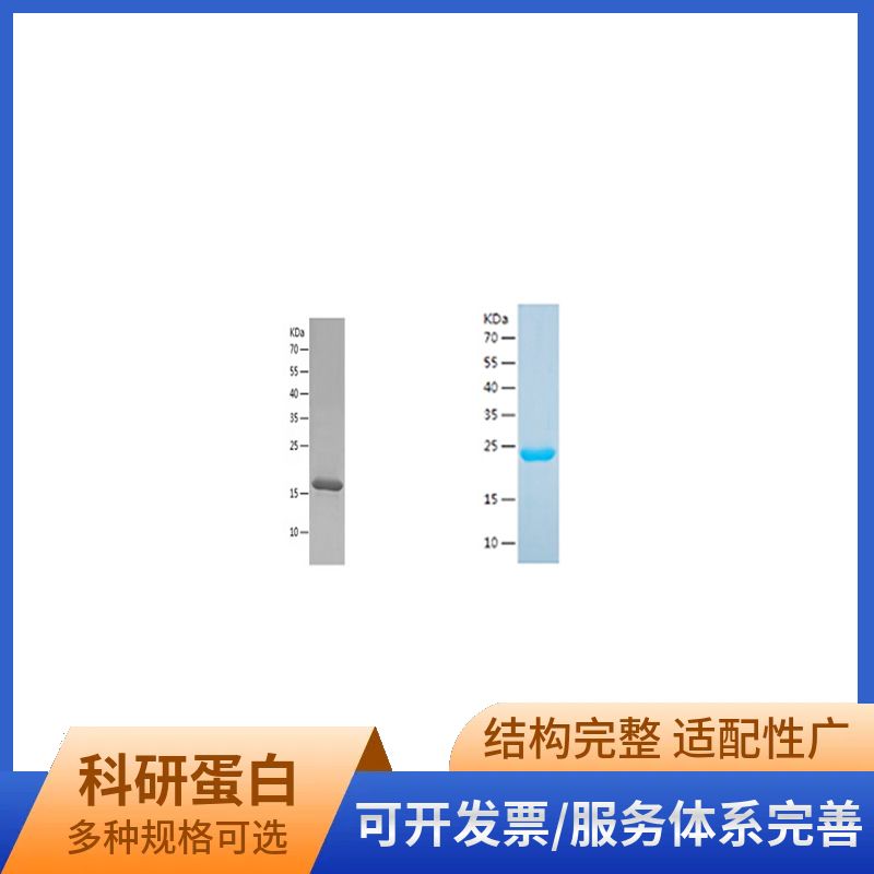 Recombinant Human Cystatin-B