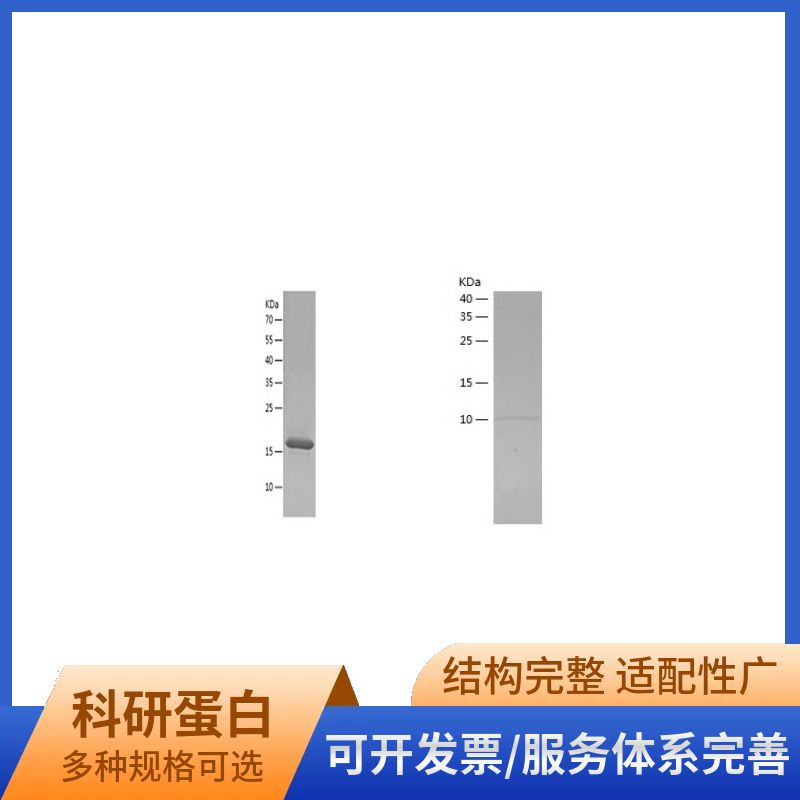 Recombinant Human Histone H2A.X