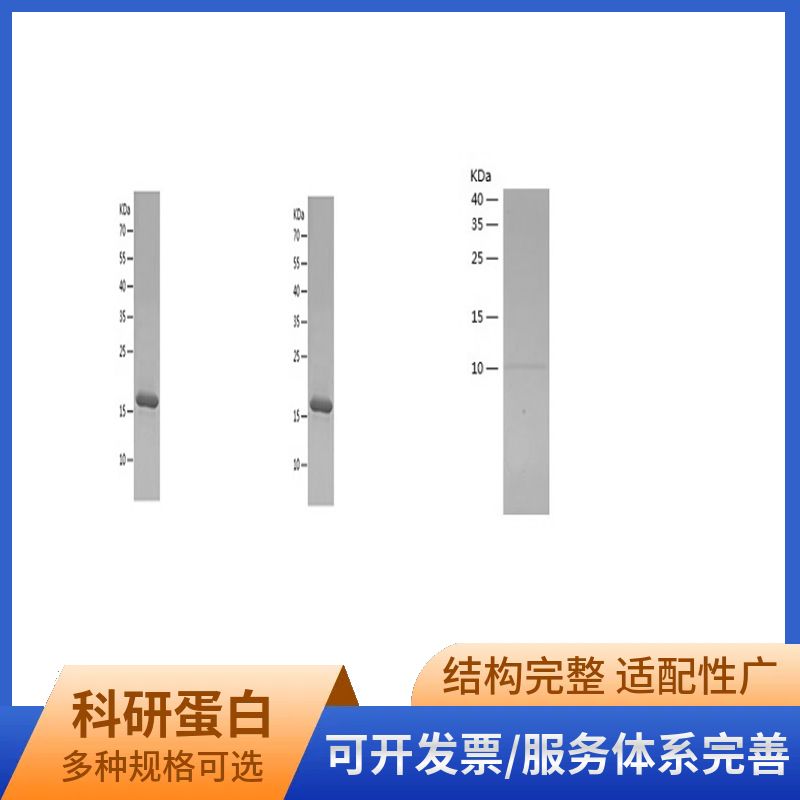 Recombinant Human Histone H2B