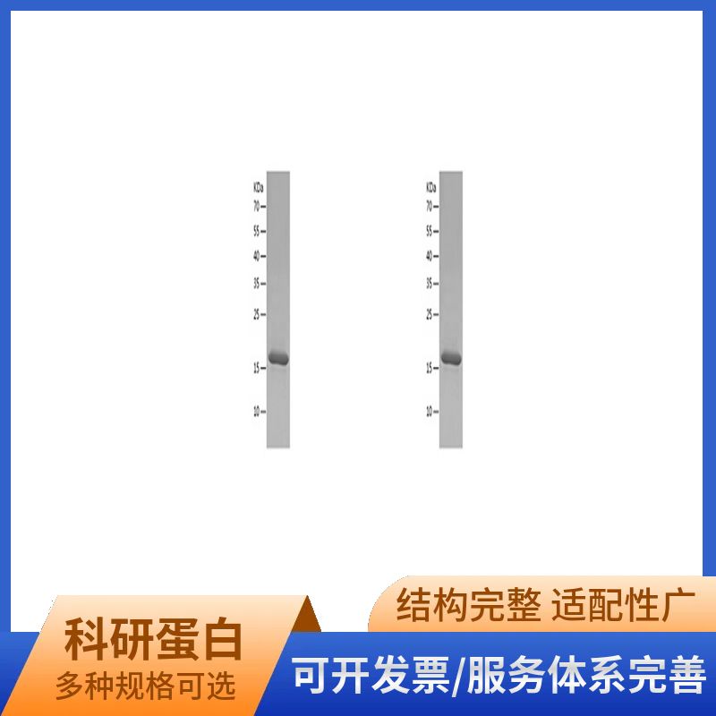 Recombinant Human NHP2