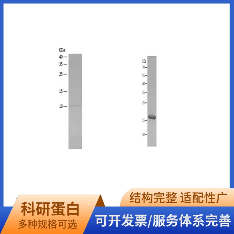 Recombinant Human NHP2