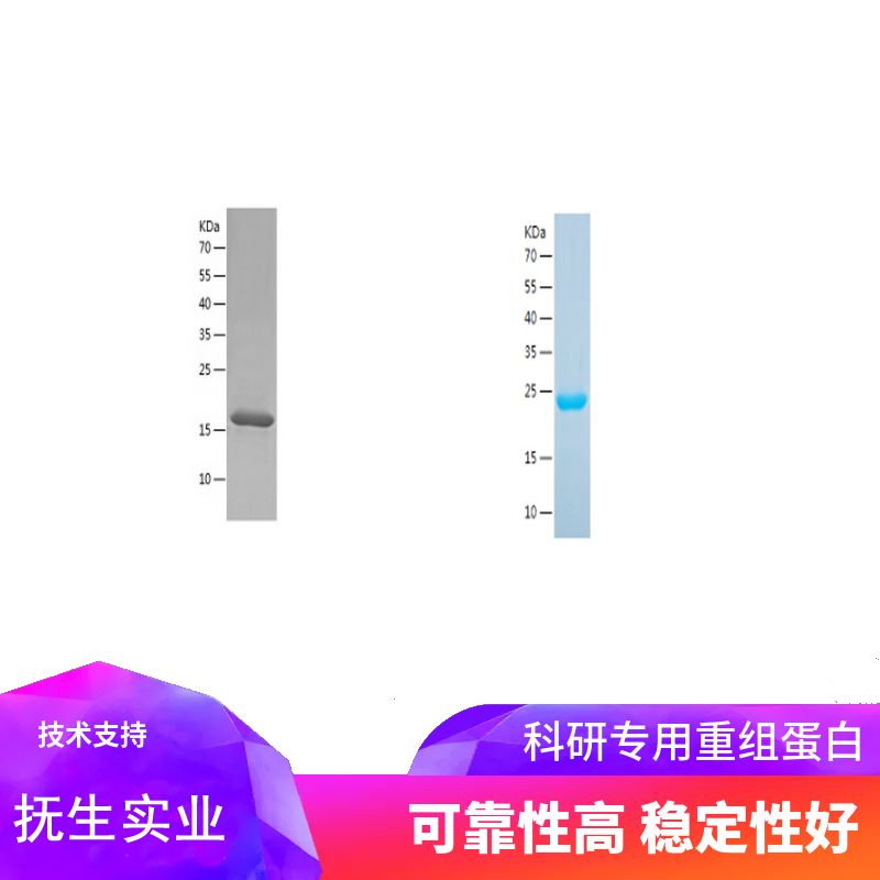 Recombinant Human DDIT3