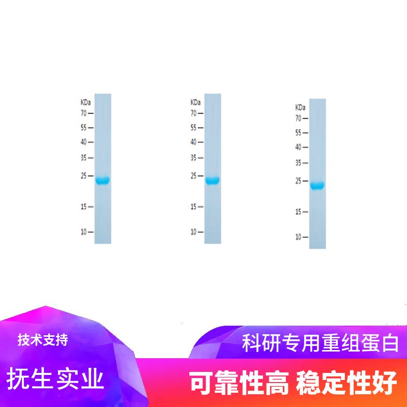 Recombinant Human FABP1