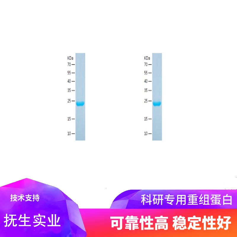 Recombinant Human FABP1