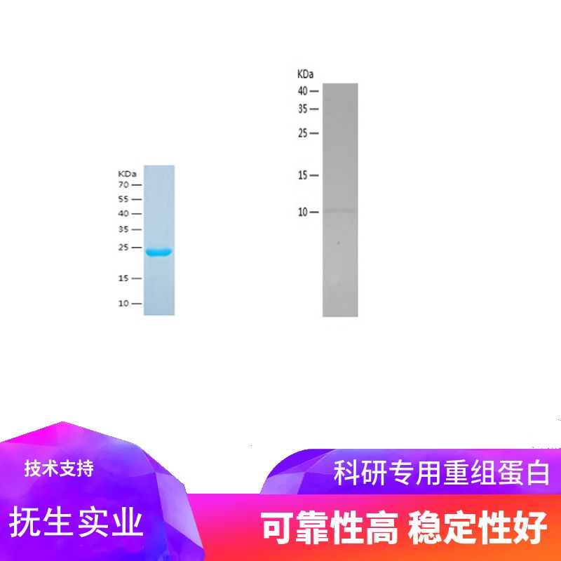 Recombinant Human FABP1