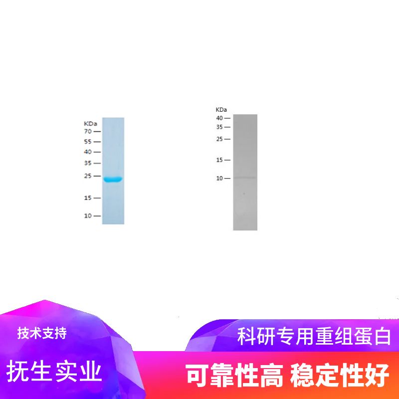 Recombinant Human FABP1