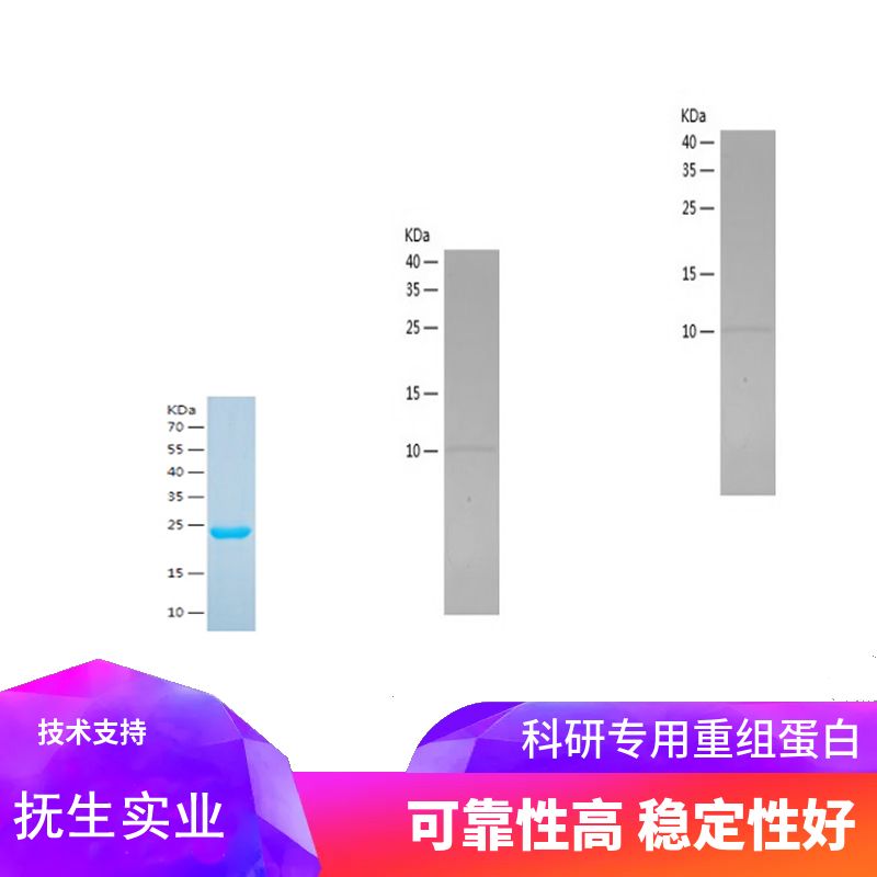 Recombinant Human MYL9
