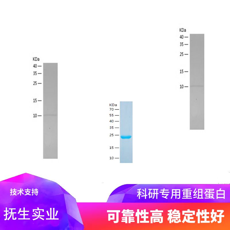 Recombinant Human MYL9