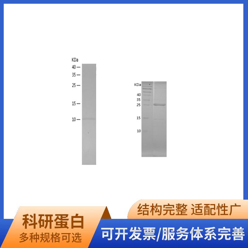 Recombinant Human NME2