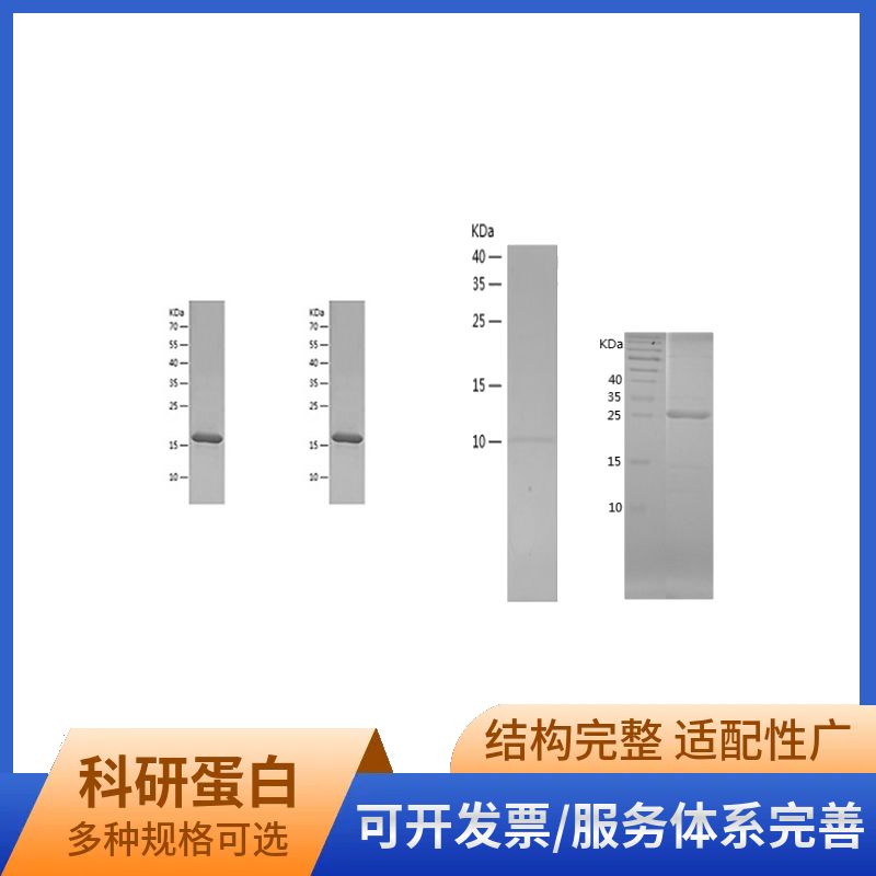 Recombinant Human MT3