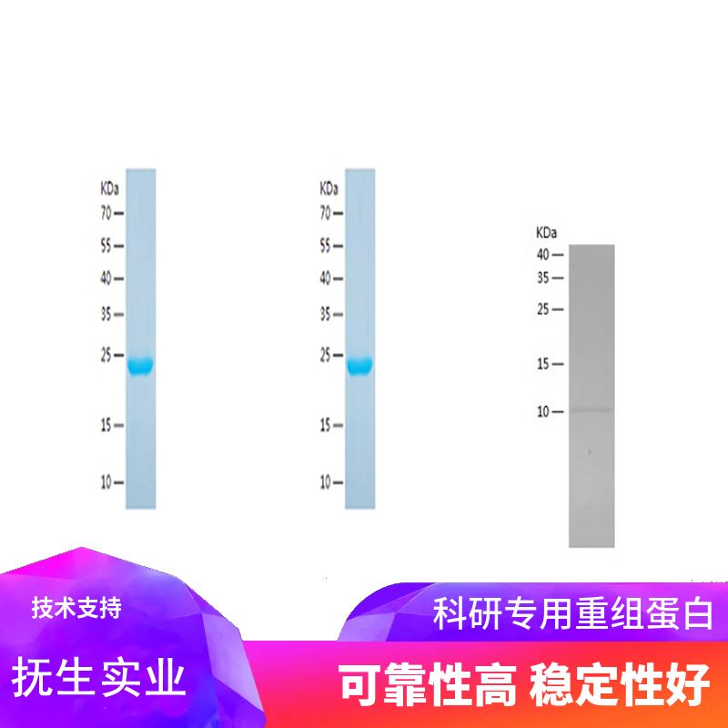 Recombinant Human PFDN5