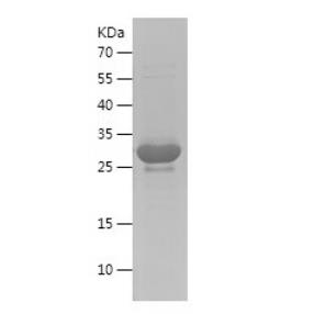 Recombinant Human Aquaporin 4.png