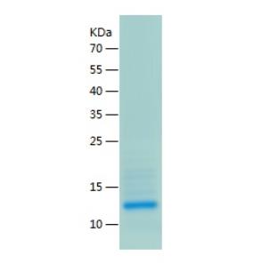 Recombinant Human CCL1.png