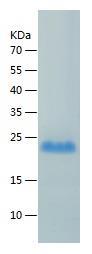 Recombinant Human CD20.jpg