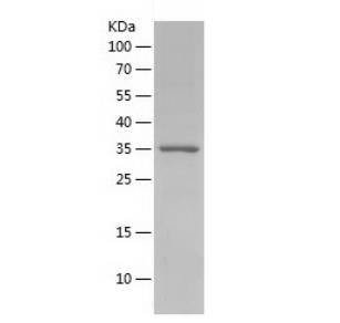 Recombinant Human CD9.png