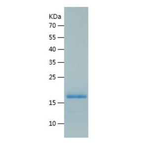 Recombinant Human CDA.png
