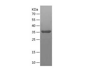 Recombinant Human CDK2AP2.png