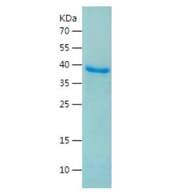 Recombinant Human CNBP.png