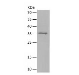 Recombinant Human COTL1.png