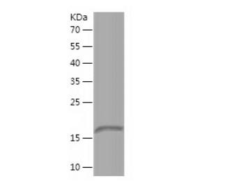 Recombinant Human COX5A.png