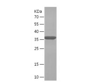Recombinant Human CRABP2.png