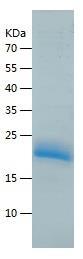 Recombinant Human CRYGD.jpg