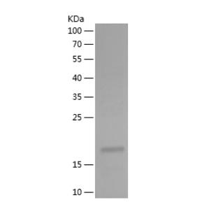 Recombinant Human CTBP2.png