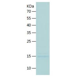 Recombinant Human CTLA4.png