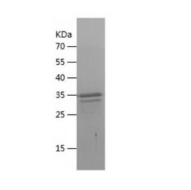 Recombinant Human CXCL14.png