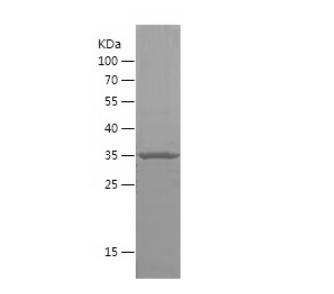 Recombinant Human DHH.png